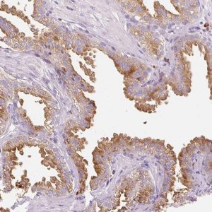 Anti-TMC8 antibody produced in rabbit 
