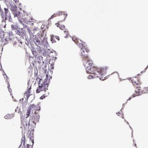 Anti-TMEM100 antibody produced in rabbit 