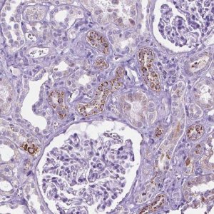 Anti-TMEM132E antibody produced in rabbit 