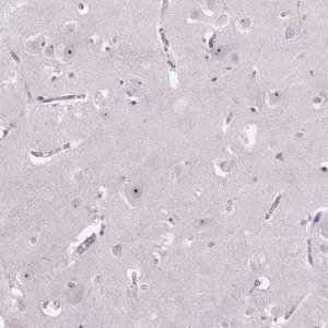 Anti-TMEM151B antibody produced in rabbit 