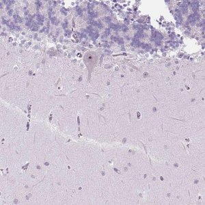 Anti-TMEM151B antibody produced in rabbit 
