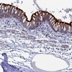 Anti-TMEM161A antibody produced in rabbit 