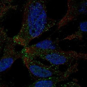 Anti-TMEM178A antibody produced in rabbit 