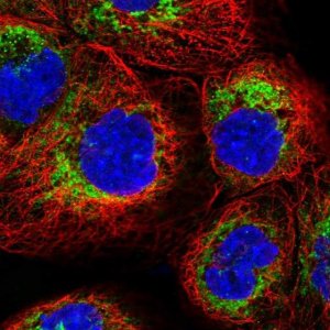 Anti-TMEM18 antibody produced in rabbit 