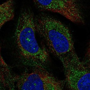 Anti-TMEM212 antibody produced in rabbit 