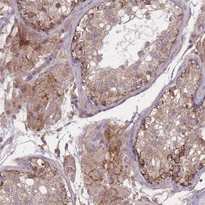 Anti-TMEM232 antibody produced in rabbit 