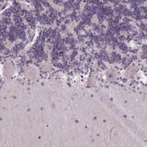Anti-TMEM240 antibody produced in rabbit 