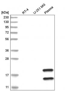 Anti-TMEM241 antibody produced in rabbit HPA029489-100UL