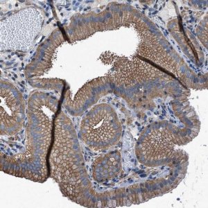 Anti-TMEM261 antibody produced in rabbit 
