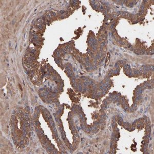 Anti-TMEM268 antibody produced in rabbit 