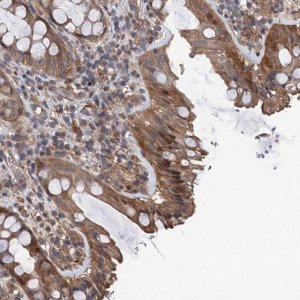 Anti-TMEM39B antibody produced in rabbit 