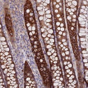 Anti-TMEM44 antibody produced in rabbit 