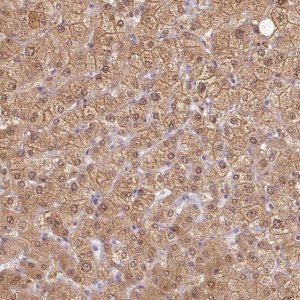 Anti-TMEM45A antibody produced in rabbit 