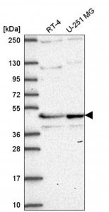 Anti-TMEM5 antibody produced in rabbit 