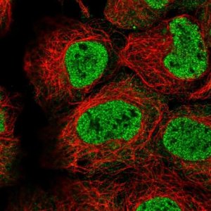 Anti-TMEM98 antibody produced in rabbit 