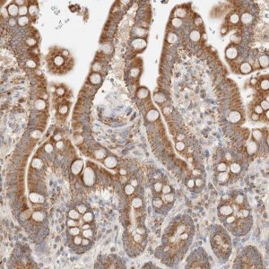 Anti-TMPPE antibody produced in rabbit 