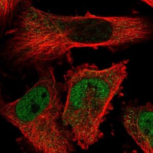 Anti-TMPPE antibody produced in rabbit 