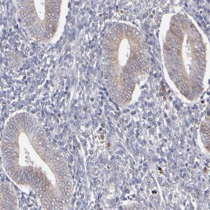 Anti-TMX1 antibody produced in rabbit 