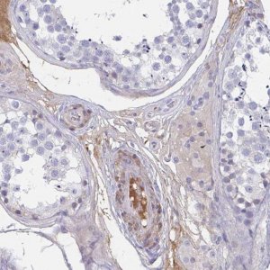 Anti-TNFAIP6 antibody produced in rabbit 