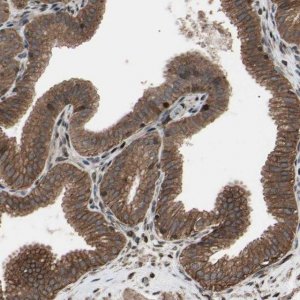 Anti-TNFRSF1A antibody produced in rabbit 