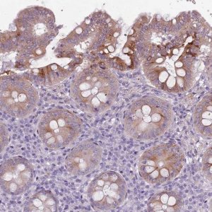 Anti-TNFRSF6B antibody produced in rabbit 