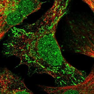 Anti-TNRC18 antibody produced in rabbit 