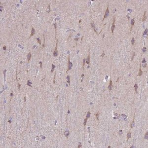 Anti-TOMM40 antibody produced in rabbit 