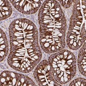 Anti-TOMM40 antibody produced in rabbit 