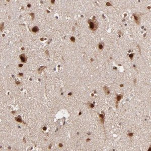 Anti-TOP1MT antibody produced in rabbit 