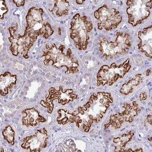 Anti-TP53I11 antibody produced in rabbit 