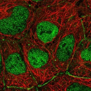 Anti-TP73 antibody produced in rabbit HPA027314-100UL