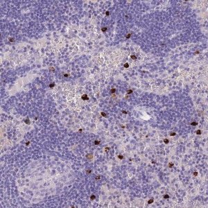 Anti-TPSD1 antibody produced in rabbit 