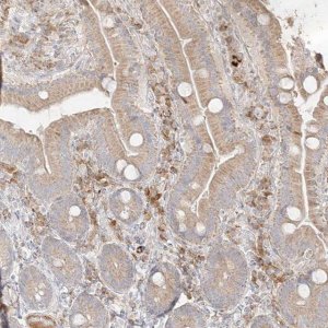 Anti-TRANK1 antibody produced in rabbit 