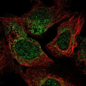 Anti-TRAPPC2 antibody produced in rabbit 