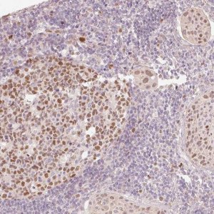 Anti-TREX2 antibody produced in rabbit 