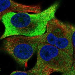 Anti-TRIB1 antibody produced in rabbit 