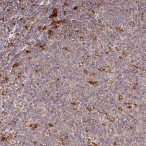 Anti-TRIM14 antibody produced in rabbit 