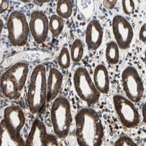 Anti-TRIM25 antibody produced in rabbit 
