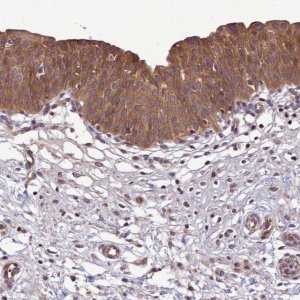 Anti-TRIM31 antibody produced in rabbit 