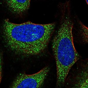 Anti-TRIM39 antibody produced in rabbit 