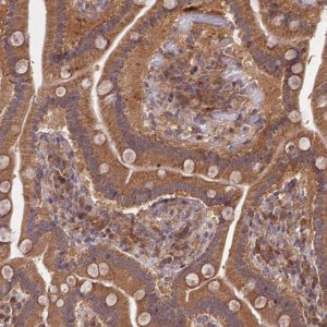 Anti-TRIM40 antibody produced in rabbit 