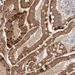 Anti-TRIM41 antibody produced in rabbit 