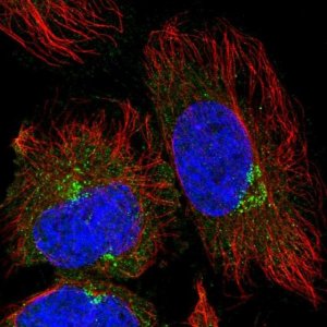 Anti-TRIM44 antibody produced in rabbit 