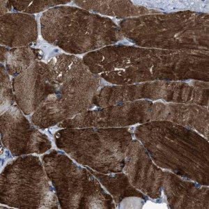 Anti-TRIM54 antibody produced in rabbit 