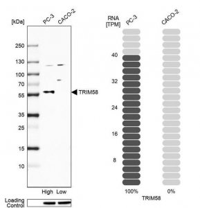 Anti-TRIM58 antibody produced in rabbit 