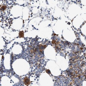 Anti-TRIM58 antibody produced in rabbit 