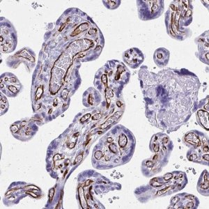 Anti-TRIM6 antibody produced in rabbit 