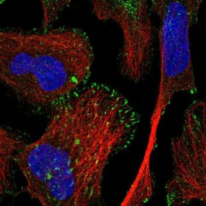 Anti-TRIM62 antibody produced in rabbit 