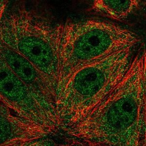 Anti-TRIM65 antibody produced in rabbit 