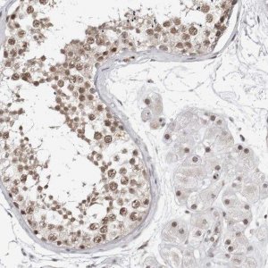 Anti-TRIM66 antibody produced in rabbit 